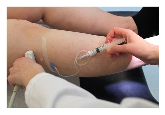 Ευρυαγγείες_φωτογραφία