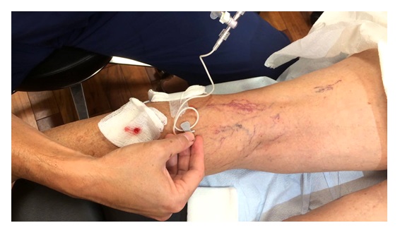 Ευρυαγγείες_φωτογραφία