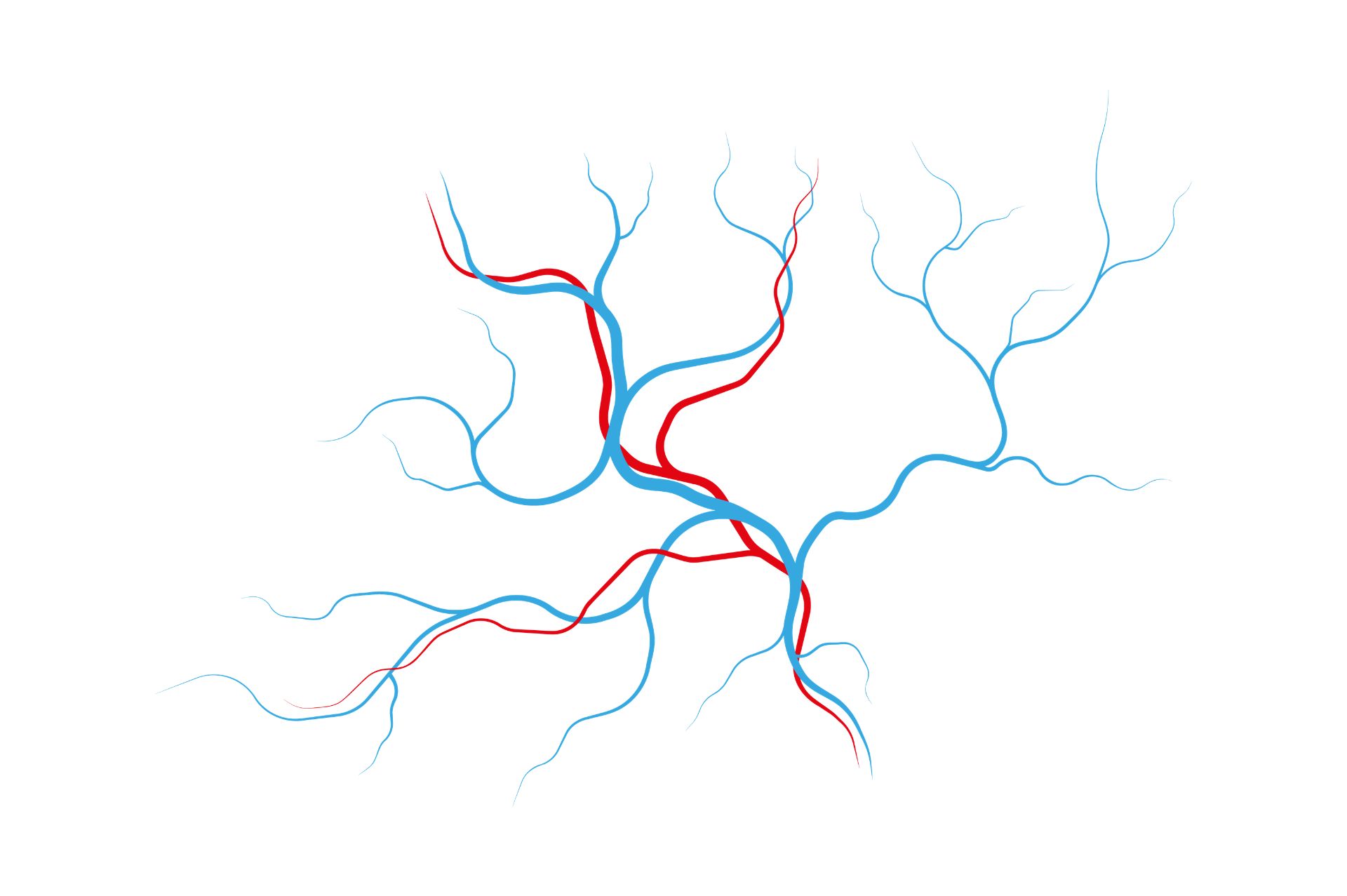 θεραπεία για ευρυαγγείες